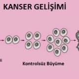 KANSER AMELİYATI CERRAHİSİ NEDİR ?