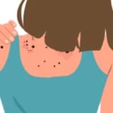 Hemanjiom Belirtileri