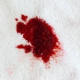 Kızlık Zarı Kanama Miktarı Nedir?