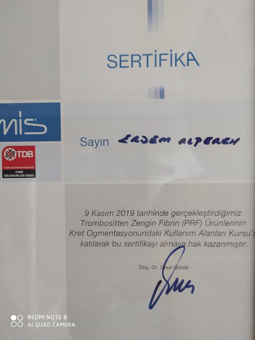 Kret Augmentasyon ve PRF kullanımı